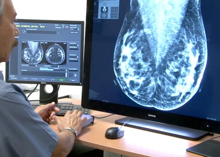 Por tabúes y machismo las mujeres no se practican la mastografía