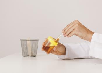 Prueba de orina podría detectar el cáncer cervicouterino