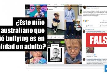 Quaden Bayles sufrió bullying por su condición, Sí tiene nueve años y NO es un adulto como aseguran en redes