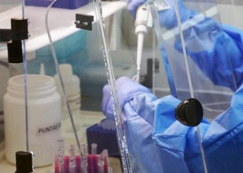 Asegura SSZ contar con infraestructura para analizar muestras del Covid-19