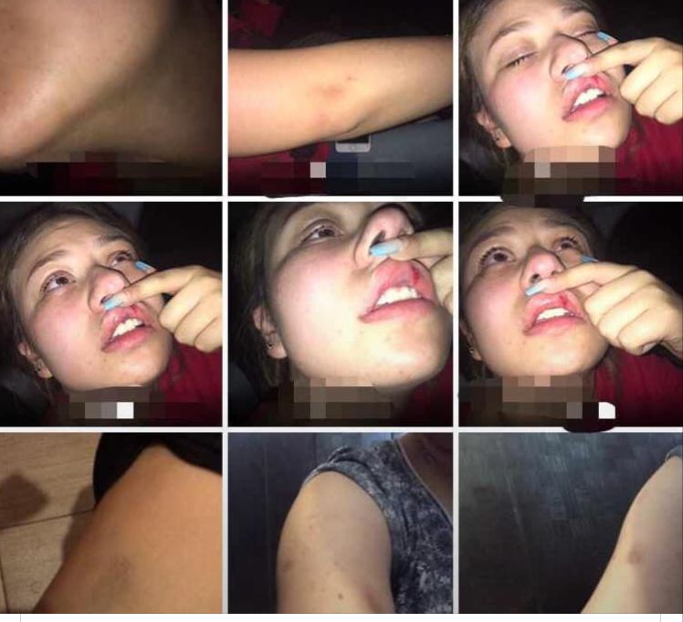 Localizan joven desaparecida con diversas lesiones por golpes